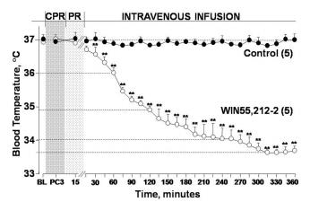 Intravenous Infusion