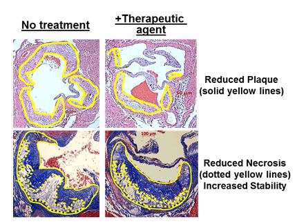 data for comparing non-treated and therapeutic treated 